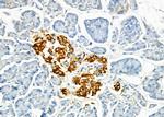 ME2 Antibody in Immunohistochemistry (Paraffin) (IHC (P))