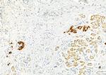 ME2 Antibody in Immunohistochemistry (Paraffin) (IHC (P))