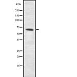 ME2 Antibody in Western Blot (WB)