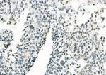 MED31 Antibody in Immunohistochemistry (Paraffin) (IHC (P))