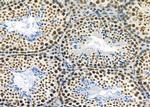 MED31 Antibody in Immunohistochemistry (Paraffin) (IHC (P))