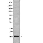 MED31 Antibody in Western Blot (WB)