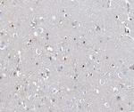 MEF2C Antibody in Immunohistochemistry (Paraffin) (IHC (P))