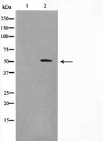 Menin Antibody in Western Blot (WB)