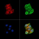 MUT Antibody in Immunocytochemistry (ICC/IF)