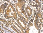 MUT Antibody in Immunohistochemistry (Paraffin) (IHC (P))