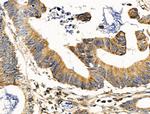 MUT Antibody in Immunohistochemistry (Paraffin) (IHC (P))