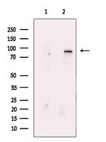 MUT Antibody in Western Blot (WB)