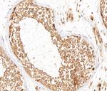 MMP16 Antibody in Immunohistochemistry (Paraffin) (IHC (P))