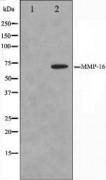 MMP16 Antibody in Western Blot (WB)