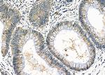 MRPL19 Antibody in Immunohistochemistry (Paraffin) (IHC (P))