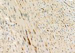 MRPL19 Antibody in Immunohistochemistry (Paraffin) (IHC (P))