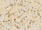 MRPL19 Antibody in Immunohistochemistry (Paraffin) (IHC (P))