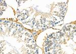 MRPL19 Antibody in Immunohistochemistry (Paraffin) (IHC (P))