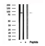 MSK2 Antibody in Western Blot (WB)