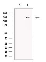 MTR Antibody in Western Blot (WB)