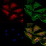 MYBPC3 Antibody in Immunocytochemistry (ICC/IF)