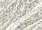 MYBPC3 Antibody in Immunohistochemistry (Paraffin) (IHC (P))