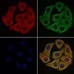 CD56 Antibody in Immunocytochemistry (ICC/IF)