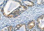 CD56 Antibody in Immunohistochemistry (Paraffin) (IHC (P))