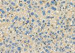 CD56 Antibody in Immunohistochemistry (Paraffin) (IHC (P))