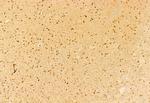 NCOA4 Antibody in Immunohistochemistry (Paraffin) (IHC (P))