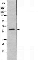 NKp46 (CD335) Antibody in Western Blot (WB)