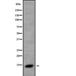 NDUFS6 Antibody in Western Blot (WB)