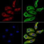 Nesprin 1 Antibody in Immunocytochemistry (ICC/IF)