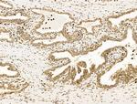 Nesprin 1 Antibody in Immunohistochemistry (Paraffin) (IHC (P))