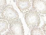 Nesprin 1 Antibody in Immunohistochemistry (Paraffin) (IHC (P))