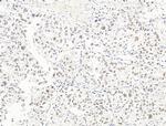 Nesprin 1 Antibody in Immunohistochemistry (Paraffin) (IHC (P))