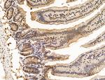 Nesprin 1 Antibody in Immunohistochemistry (Paraffin) (IHC (P))