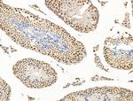 Nesprin 1 Antibody in Immunohistochemistry (Paraffin) (IHC (P))