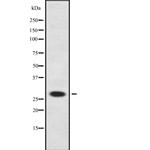 Neurogenin 2 Antibody in Western Blot (WB)