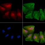 NRGN Antibody in Immunocytochemistry (ICC/IF)