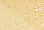 NLRP3 Antibody in Immunohistochemistry (Paraffin) (IHC (P))