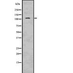 NLRP3 Antibody in Western Blot (WB)