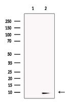 NOLA3 Antibody in Western Blot (WB)