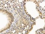 NOTCH4 Antibody in Immunohistochemistry (Paraffin) (IHC (P))