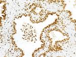 PXR Antibody in Immunohistochemistry (Paraffin) (IHC (P))