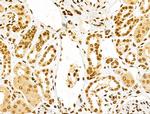 PXR Antibody in Immunohistochemistry (Paraffin) (IHC (P))