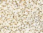 PXR Antibody in Immunohistochemistry (Paraffin) (IHC (P))