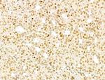 PXR Antibody in Immunohistochemistry (Paraffin) (IHC (P))