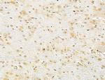 PXR Antibody in Immunohistochemistry (Paraffin) (IHC (P))