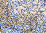 N-Ras Antibody in Immunohistochemistry (Paraffin) (IHC (P))