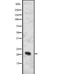 N-Ras Antibody in Western Blot (WB)