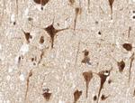 NFE2L2 Antibody in Immunohistochemistry (Paraffin) (IHC (P))