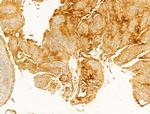 NFE2L2 Antibody in Immunohistochemistry (Paraffin) (IHC (P))