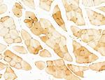 NFE2L2 Antibody in Immunohistochemistry (Paraffin) (IHC (P))